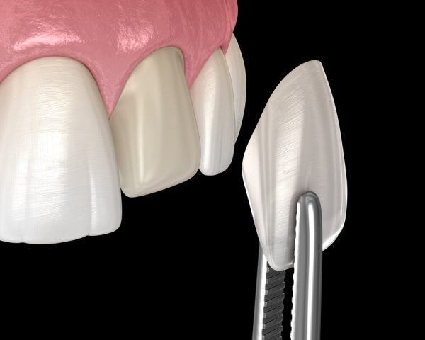 Dentistry Kraft - Clinica stomatologica Non Stop